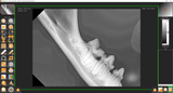 Veterinary Dental X-Ray Imaging Software and Templates