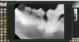 Veterinary Dental X-Ray Imaging Software and Templates