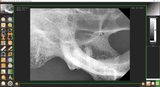 Veterinary Dental X-Ray Imaging Software and Templates